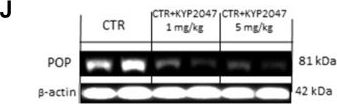 Fig.5.J showing Western Blotting from the publication: Beneficial effect of KYP-2047, a propyl-oligopeptidase inhibitor, on oral squamous cell carcinoma.