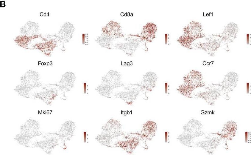 Fig.6.B showing Immunohistochemistry in a Mus musculus (House mouse) sample from the publication: Footprint of pancreas infiltrating and circulating immune cells throughout type 1 diabetes development.
