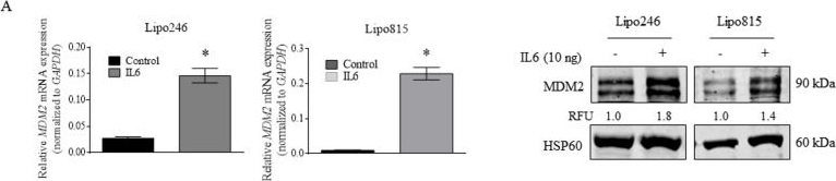 Fig.4.A showing Western Blotting in a Homo sapiens (Human) sample from the publication: Blockade of interleukin-6 (IL-6) signaling in dedifferentiated liposarcoma (DDLPS) decreases mouse double minute 2 (MDM2) oncogenicity via alternative splicing.