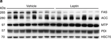 Fig.3.A showing Western Blotting in a Rattus norvegicus (Rat) sample from the publication: Brain leptin reduces liver lipids by increasing hepatic triglyceride secretion and lowering lipogenesis.