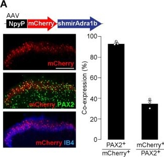 Fig.2.A showing Immunohistochemistry-immunofluorescence from the publication: Identification of Spinal Inhibitory Interneurons Required for Attenuating Effect of Duloxetine on Neuropathic Allodynia-like Signs in Rats.