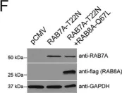 Fig.10.F showing Western Blotting in a Homo sapiens (Human) sample from the publication: The G2019S variant of leucine-rich repeat kinase 2 (LRRK2) alters endolysosomal trafficking by impairing the function of the GTPase RAB8A.