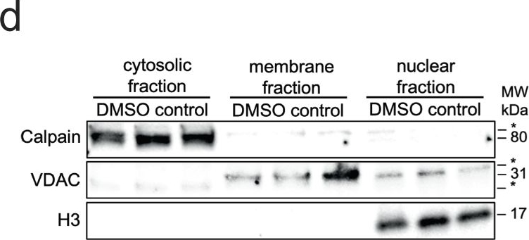 Fig.4.D showing Western Blotting in a Homo sapiens (Human) sample from the publication: Harnessing PROTAC technology to combat stress hormone receptor activation.
