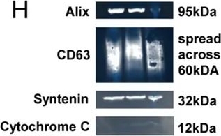Fig.1.H showing Western Blotting in a Homo sapiens (Human) sample from the publication: Placental Small Extracellular Vesicles Undetected in Cerebrospinal Fluid of Preeclamptic and Eclamptic Women.