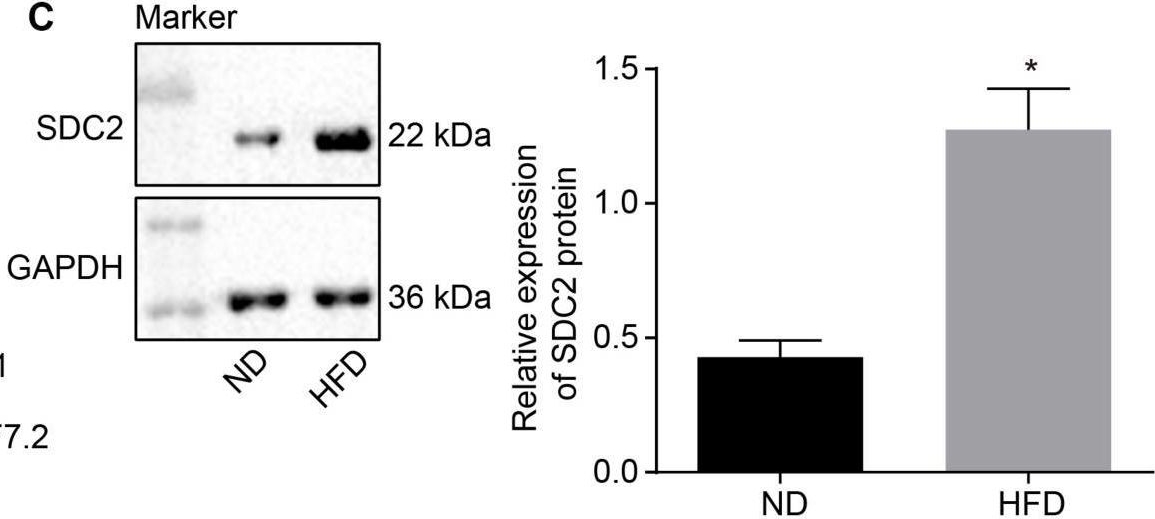 Fig.1.C showing Western Blotting in a Mus musculus (House mouse) sample from the publication: microRNA-9 Inhibits Vulnerable Plaque Formation and Vascular Remodeling via Suppression of the SDC2-Dependent FAK/ERK Signaling Pathway in Mice With Atherosclerosis.