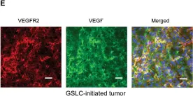 Fig.4.E showing Immunohistochemistry-immunofluorescence in a Homo sapiens (Human) sample from the publication: Vascular endothelial growth factor receptor 2 (VEGFR-2) plays a key role in vasculogenic mimicry formation, neovascularization and tumor initiation by Glioma stem-like cells.