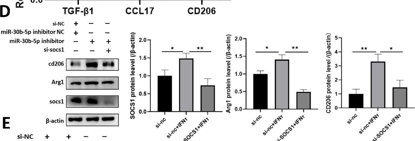 Fig.5.D showing Western Blotting from the publication: IFN-τ Maintains Immune Tolerance by Promoting M2 Macrophage Polarization via Modulation of Bta-miR-30b-5p in Early Uterine Pregnancy in Dairy Cows.