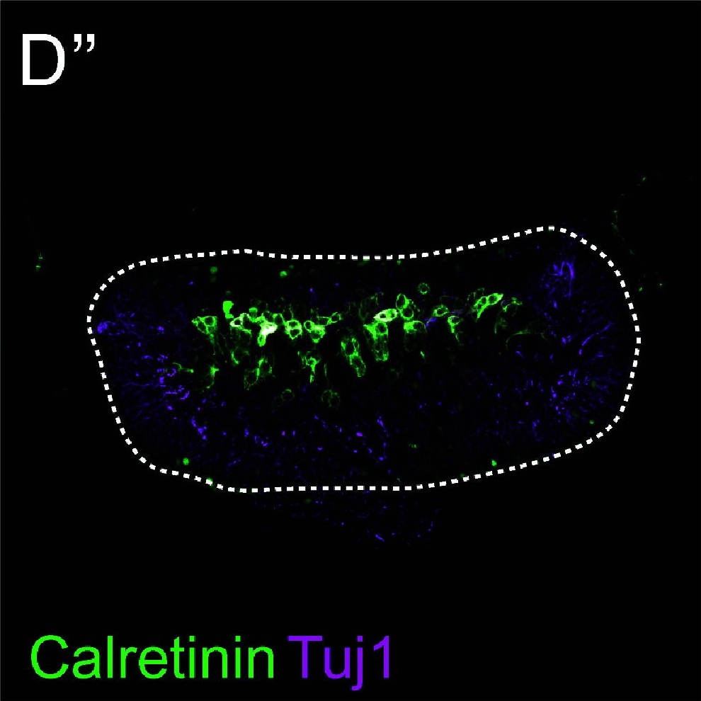 Fig.3.D showing Immunohistochemistry-immunofluorescence in a Mus musculus (House mouse) sample from the publication: Type I hair cells of striolar and central zones in vestibular organs are essential for head stability and postural control.