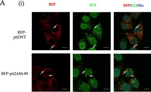 Fig.4.A showing Immunocytochemistry-immunofluorescence in a Mus musculus (House mouse) sample from the publication: Precise Mapping of the Proteasome Interaction Region (PIR) of p62/SQSTM1: Decoupling Condensate Formation from Proteasome Recruitment.