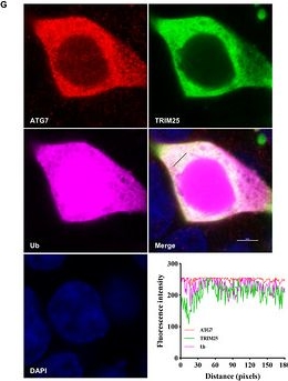Fig.6.G showing Immunocytochemistry-immunofluorescence from the publication: ZNF33B Promotes Japanese Encephalitis Virus Infection by Regulating the Stability of M6A-Modified Trim25 to Control the Autophagy Process.