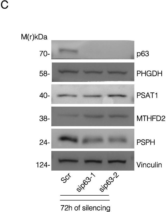 Fig.3.C showing Western Blotting in a Homo sapiens (Human) sample from the publication: p63 orchestrates serine and one carbon metabolism enzymes expression in head and neck cancer.