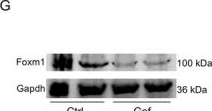 Fig.2.G showing Western Blotting from the publication: Targeting Egfr-Mediated Cell Proliferation and Lipid Metabolism Separation Effectively Accelerate Liver Regeneration.