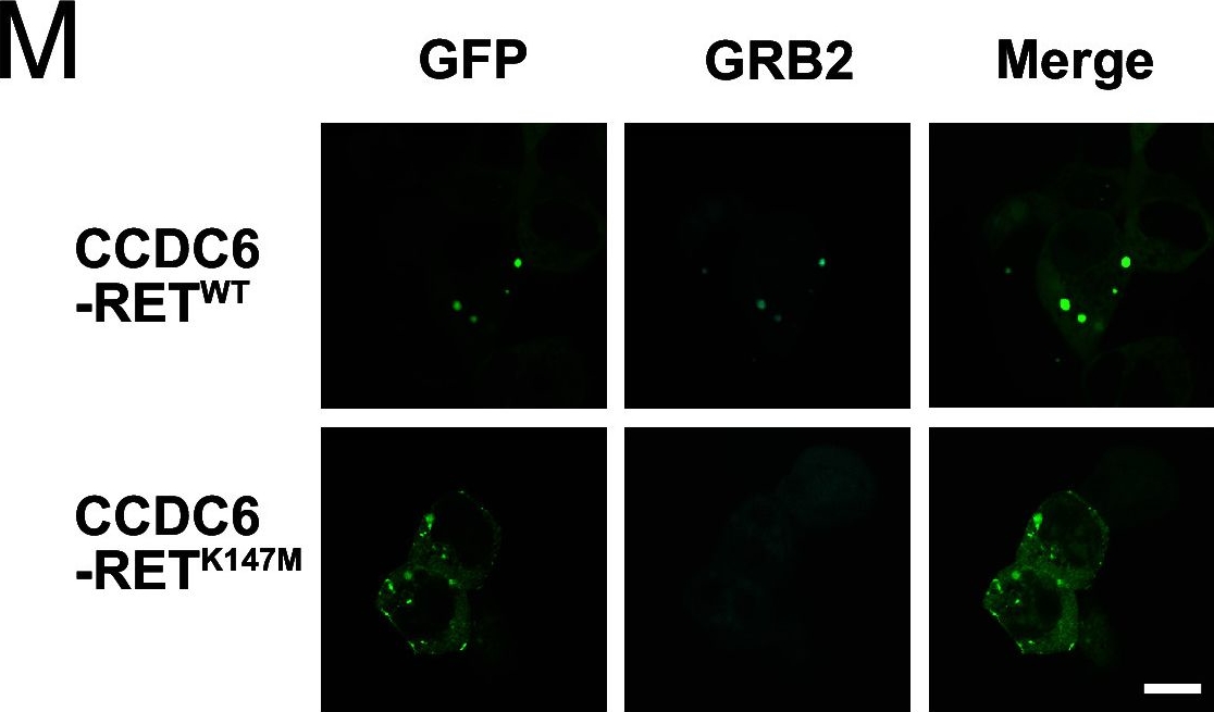 Fig.5.M showing Immunocytochemistry-immunofluorescence in a Homo sapiens (Human) sample from the publication: CCDC6-RET fusion protein regulates Ras/MAPK signaling through the fusion- GRB2-SHC1 signal niche.