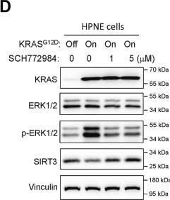 Fig.2.D showing Western Blotting from the publication: KRASG12D mutation promotes pancreatic tumorigenesis by suppressing sirtuin three via the guanine nucleotide exchange factor RCC1.