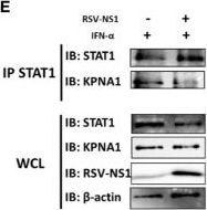 Fig.4.E showing Western Blotting from the publication: Respiratory syncytial virus NS1 inhibits anti-viral Interferon-α-induced JAK/STAT signaling, by limiting the nuclear translocation of STAT1.
