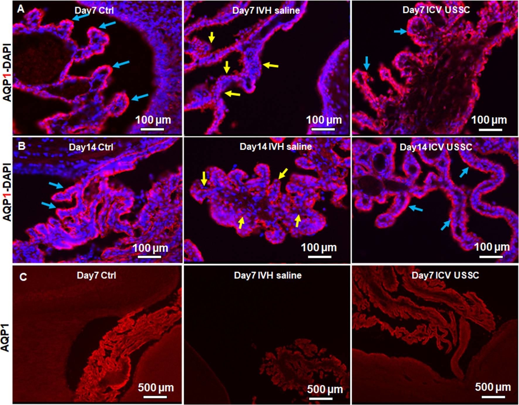 Fig.3.A,B,C showing Immunohistochemistry-immunofluorescence in an Oryctolagus cuniculus (Rabbit) sample from the publication: Human Cord Blood Derived Unrestricted Somatic Stem Cells Restore Aquaporin Channel Expression, Reduce Inflammation and Inhibit the Development of Hydrocephalus After Experimentally Induced Perinatal Intraventricular Hemorrhage.