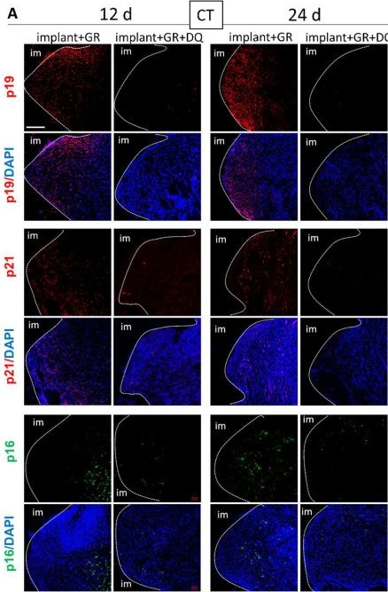Fig.8.A showing Immunocytochemistry-immunofluorescence from the publication: Identification of Senescent Cells in Peri-Implantitis and Prevention of Mini-Implant Loss Using Senolytics.