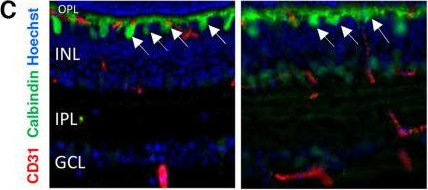 Fig.4.C showing Immunohistochemistry in a Mus musculus (House mouse) sample from the publication: In Utero Alcohol Exposure Impairs Retinal Angiogenesis and the Microvessel-Associated Positioning of Calretinin Interneurons.