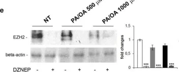 Fig.3.E showing Western Blotting from the publication: EZH2 down-regulation exacerbates lipid accumulation and inflammation in in vitro and in vivo NAFLD.