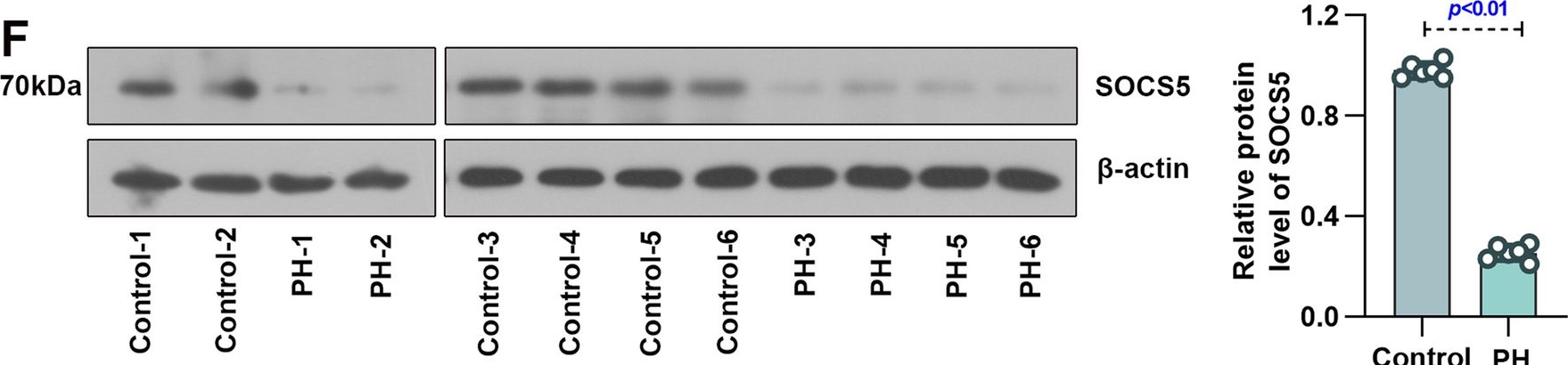 Fig.1.F showing Western Blotting in a Mus musculus (House mouse) sample from the publication: SOCS5, targeted by miR-155-5p, plays a negative regulatory role in pulmonary hypertension through inhibiting JAK2/STAT3 signaling pathway.