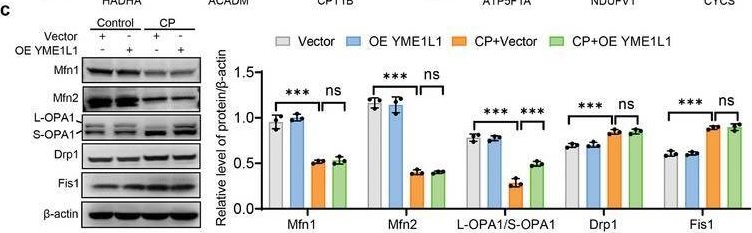 Fig.3.C showing Western Blotting from the publication: SREBP1c-Mediated Transcriptional Repression of YME1L1 Contributes to Acute Kidney Injury by Inducing Mitochondrial Dysfunction in Tubular Epithelial Cells.