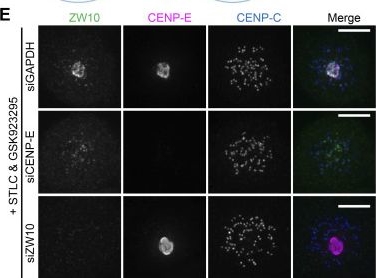 Fig.5.E showing Immunocytochemistry-immunofluorescence in a Homo sapiens (Human) sample from the publication: A farnesyl-dependent structural role for CENP-E in expansion of the fibrous corona.