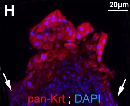 p53 and TAp63 promote keratinocyte proliferation and differentiation in breeding tubercles of the zebrafish.