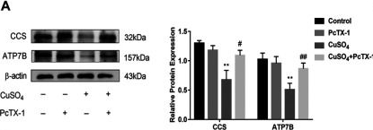 Fig.4.A showing Western Blotting in a Rattus norvegicus (Rat) sample from the publication: Inhibition of ASIC1a-Mediated ERS Improves the Activation of HSCs and Copper Transport Under Copper Load.