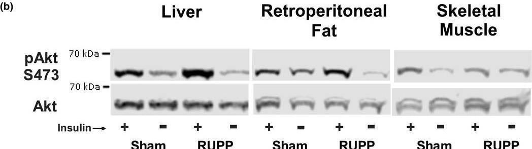Fig.5.B showing Western Blotting from the publication: Improved glucose handling in female rat offspring of a hypertensive pregnancy with intrauterine growth restriction.