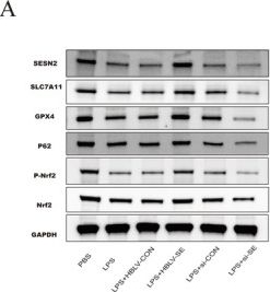 Fig.5.A showing Western Blotting from the publication: Sestrin2 Exerts a Novel Protective Effect Against LPS-Induced Ferroptosis via the Nrf2-SLC7A11-GPX4 Signaling Axis.