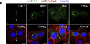 Fig.2.B showing Immunocytochemistry-immunofluorescence from the publication: GJB4 variants linked to skin disease exhibit a trafficking deficiency en route to gap junction formation that can be restored by co-expression of select connexins.