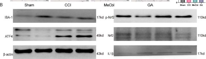 Fig.7.B showing Western Blotting in a Rattus norvegicus (Rat) sample from the publication: Gallic acid exerts therapeutic effects on sciatica by reducing inflammatory responses through the regulation of NOX4-mediated oxidative stress.