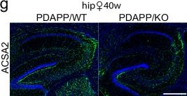 Fig.5.G showing Immunohistochemistry-immunofluorescence in a Mus musculus (House mouse) sample from the publication: Astrocytes distress triggers brain pathology through induction of δ secretase in a murine model of Alzheimer's disease.