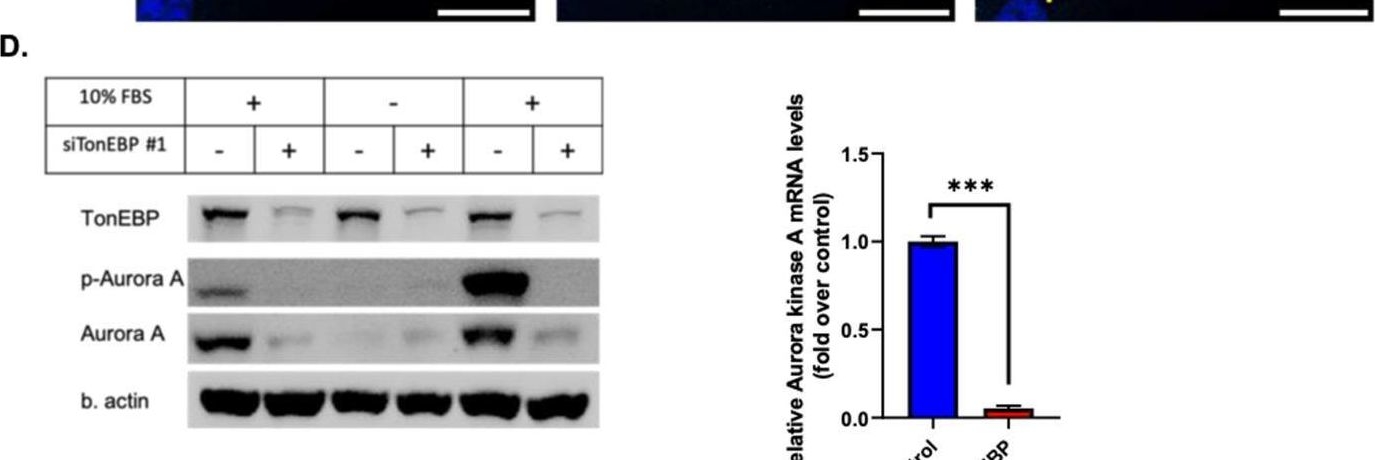 Fig.4.D showing Western Blotting in a Homo sapiens (Human) sample from the publication: TonEBP inhibits ciliogenesis by controlling aurora kinase A and regulating centriolar satellite integrity.