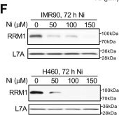 Fig.4.F showing Western Blotting in a Homo sapiens (Human) sample from the publication: Atypical genotoxicity of carcinogenic nickel(II): Linkage to dNTP biosynthesis, DNA-incorporated rNMPs, and impaired repair of TOP1-DNA crosslinks.