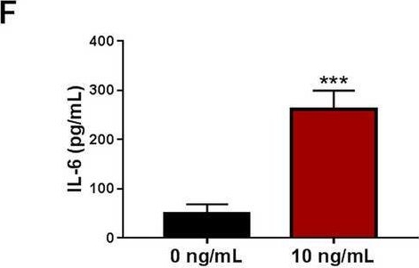 Fig.1.F showing Enzyme-linked immunosorbent assay from the publication: Circ_0020014 mediates CTSB expression and participates in IL-1β-prompted chondrocyte injury via interacting with miR-24-3p.