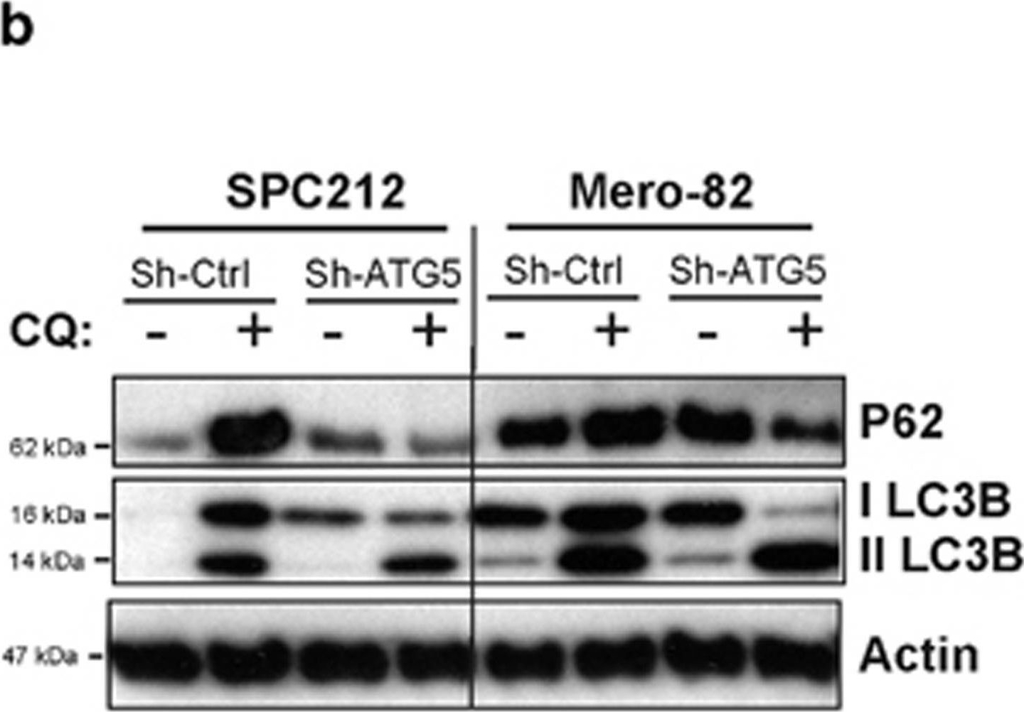 Inhibition of autophagy sensitizes malignant pleural mesothelioma cells to dual PI3K/mTOR inhibitors.