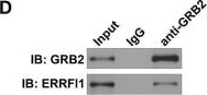 Fig.5.D showing Western Blotting from the publication: ERRFI1 exacerbates hepatic ischemia reperfusion injury by promoting hepatocyte apoptosis and ferroptosis in a GRB2-dependent manner.