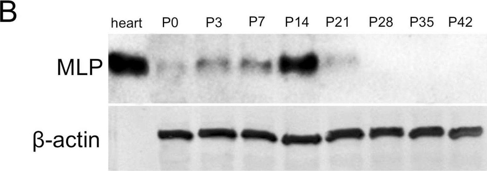 Fig.1.B showing Western Blotting from the publication: Neuronal expression of muscle LIM protein in postnatal retinae of rodents.