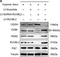 Fig.7.C showing Western Blotting in a Rattus norvegicus (Rat) sample from the publication: RUVBL2 Regulates Microglia Metabolic Reprogramming to Mediate Stress Granules Aggregation Exacerbating Postoperative Delirium in Aged Mild Cognitive Impairment Rats.