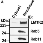 Fig.4.A showing Western Blotting in a Homo sapiens (Human) sample from the publication: TGF-β1 Augments the Apical Membrane Abundance of Lemur Tyrosine Kinase 2 to Inhibit CFTR-Mediated Chloride Transport in Human Bronchial Epithelia.
