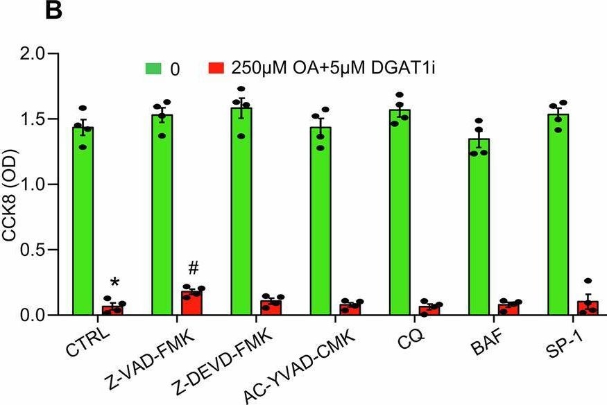 Fig.8.B from the publication: Defective lipid droplet biogenesis exacerbates oleic acid-induced cellular homeostasis disruption and ferroptosis in mouse cardiac endothelial cells.