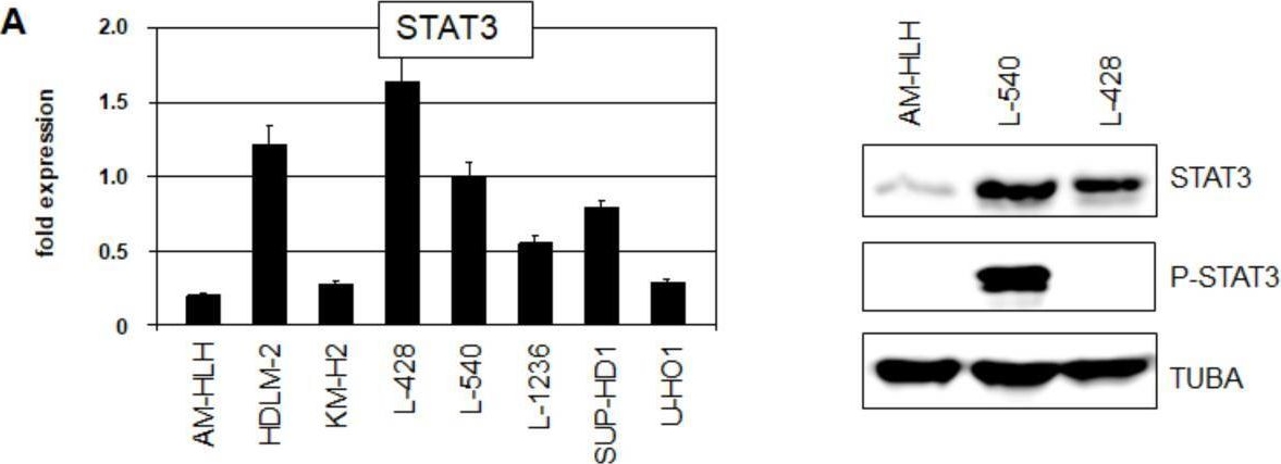 Fig.2.A from the publication: Downregulation of STAT3 in Epstein-Barr Virus-Positive Hodgkin Lymphoma.