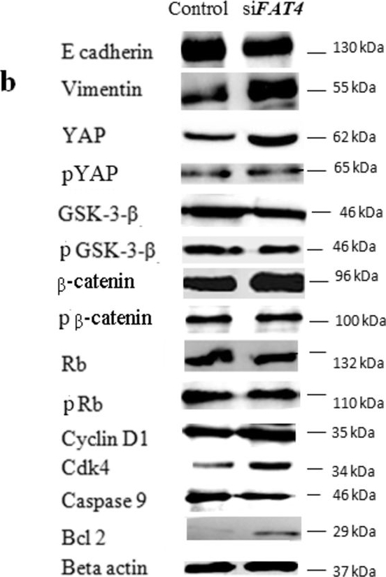 Fig.4.B showing Western Blotting in a Homo sapiens (Human) sample from the publication: FAT4 silencing promotes epithelial-to-mesenchymal transition and invasion via regulation of YAP and β-catenin activity in ovarian cancer.