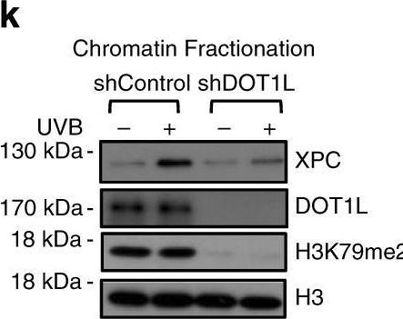 Fig.5.K showing Western Blotting from the publication: The protective role of DOT1L in UV-induced melanomagenesis.