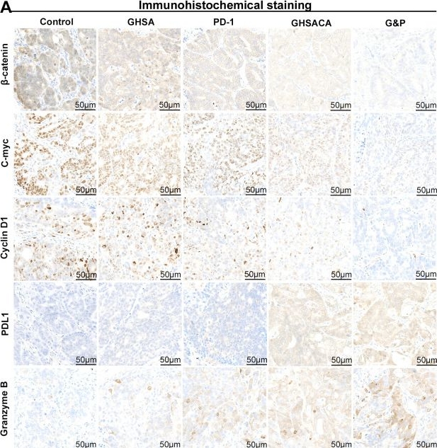 Fig.4.A showing Immunohistochemistry from the publication: LOX1-mediated supramolecular self-assembly nanomedicine for microsatellite-stable colorectal cancer towards reactivating anti-tumor immunity.