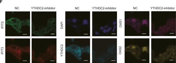 Fig.4.F showing Immunocytochemistry-immunofluorescence in a Homo sapiens (Human) sample from the publication: Downregulation of the m6A reader YTHDC2 upregulates exosome content in lung adenocarcinoma via inhibiting IFIT and OAS family members.