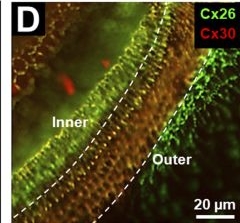 Fig.10.D showing Immunohistochemistry-immunofluorescence from the publication: A pore locus in the E1 domain differentially regulates Cx26 and Cx30 hemichannel function.