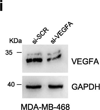 Fig.3.I showing Western Blotting in a Homo sapiens (Human) sample from the publication: Expression of ID4 protein in breast cancer cells induces reprogramming of tumour-associated macrophages.