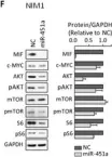 Fig.5.F showing Western Blotting from the publication: miR-451a is underexpressed and targets AKT/mTOR pathway in papillary thyroid carcinoma.